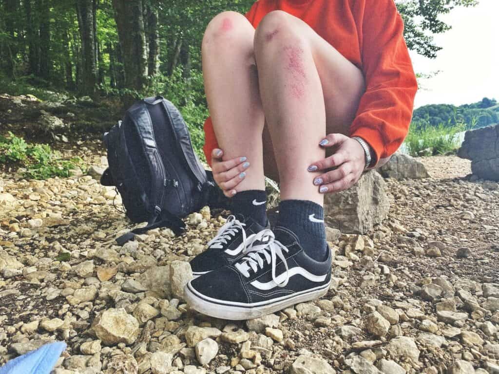 一位穿著橘色上衣與黑色短褲的女性坐在戶外碎石地上，雙膝上有明顯的紅色擦傷與血痕，旁邊放著一個黑色後背包，暗示可能因路面濕滑或意外跌倒受傷。